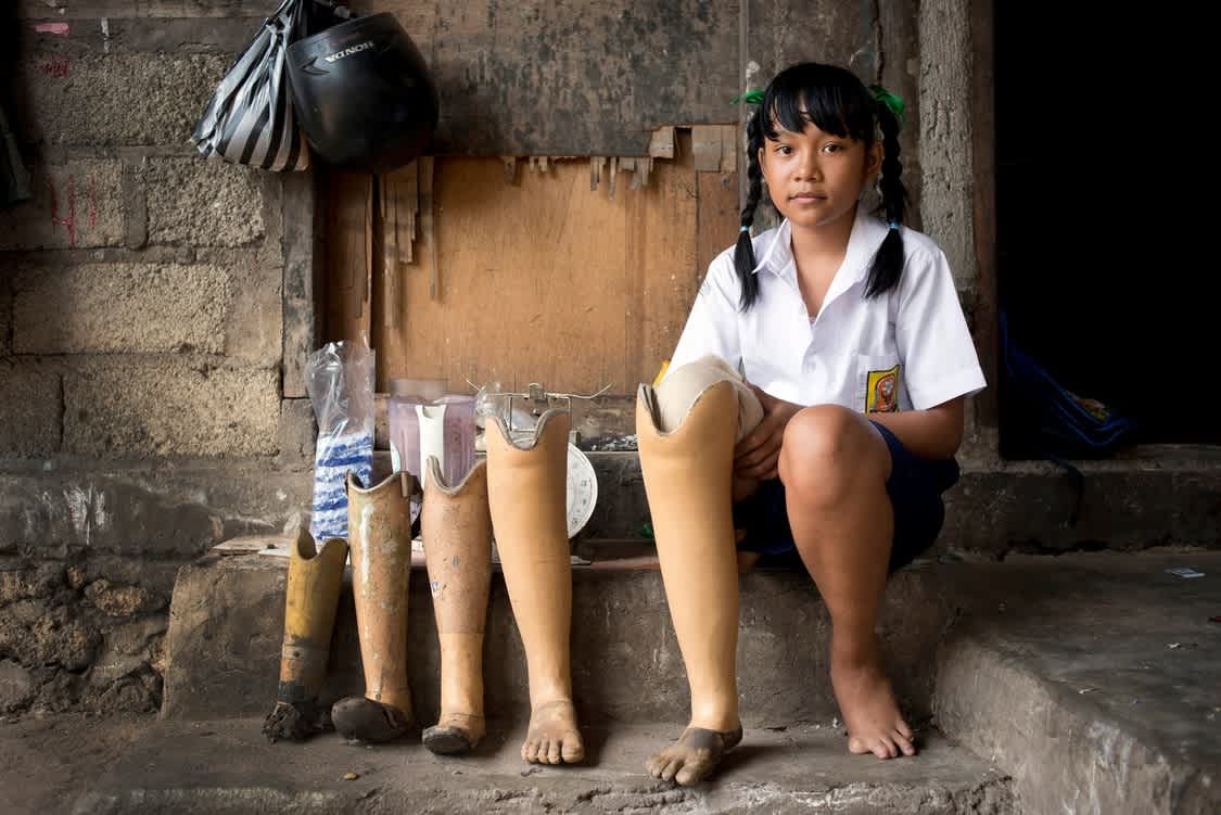 Anantara Uluwatu and Avani Seminyak support the Annika Linden Center, a facility dedicated to disabled children